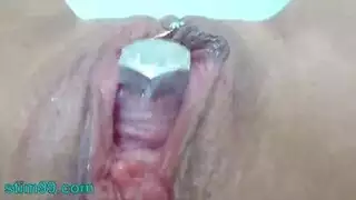 أوامر طبية: الانحناء لفحص شرجي مكثف